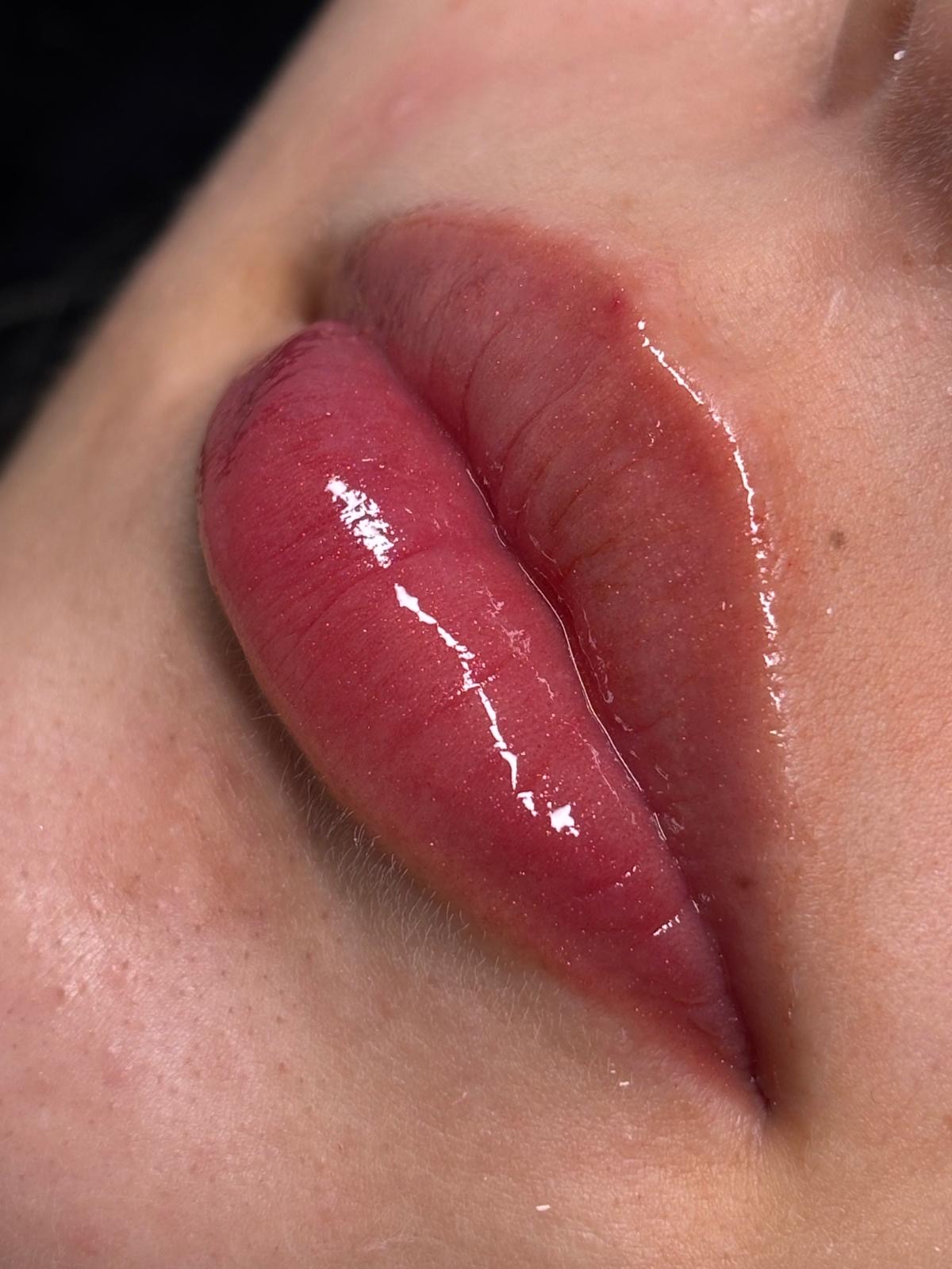 Procedimento Hydra Gloss no Studio Thalia Goulart